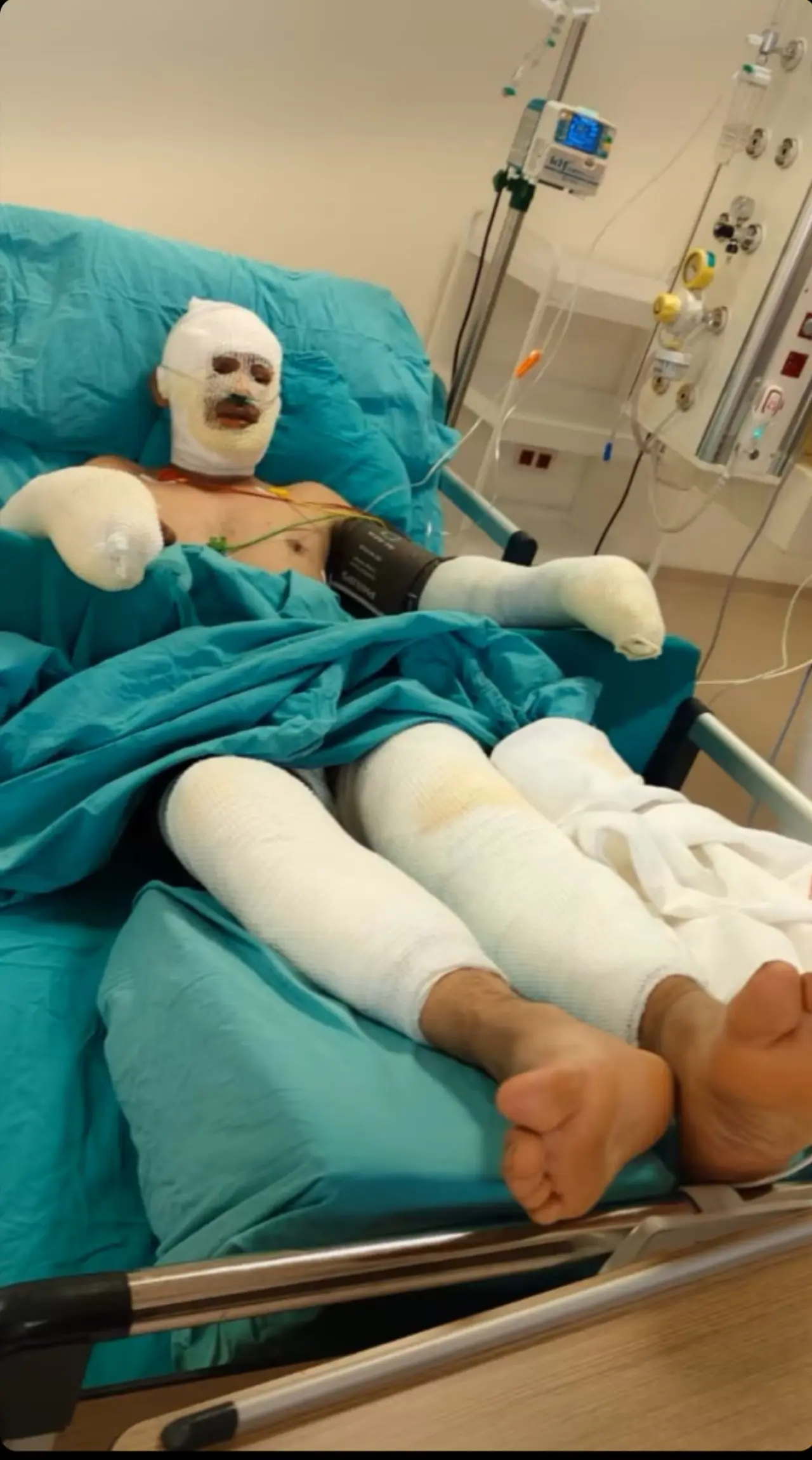 Seyitgazi Yangınında Ağır Yaralanmıştı: Kader Dereli’nin Durumu Netleşti