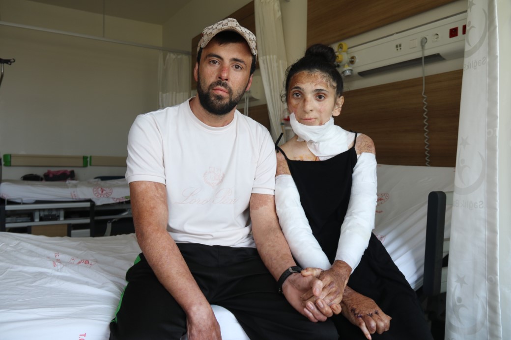 Azerbaycanlı çiftin doğal gaz patlamasında kapanan elleri, 3 yıl sonunda Eskişehir’deki tedaviyle kavuştu