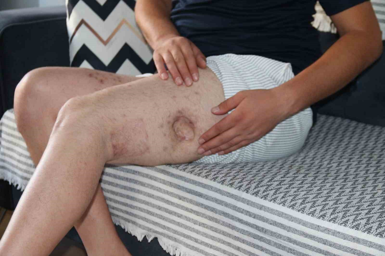 HEM VURDU HEM DE İCRA DAVASI AÇTI!