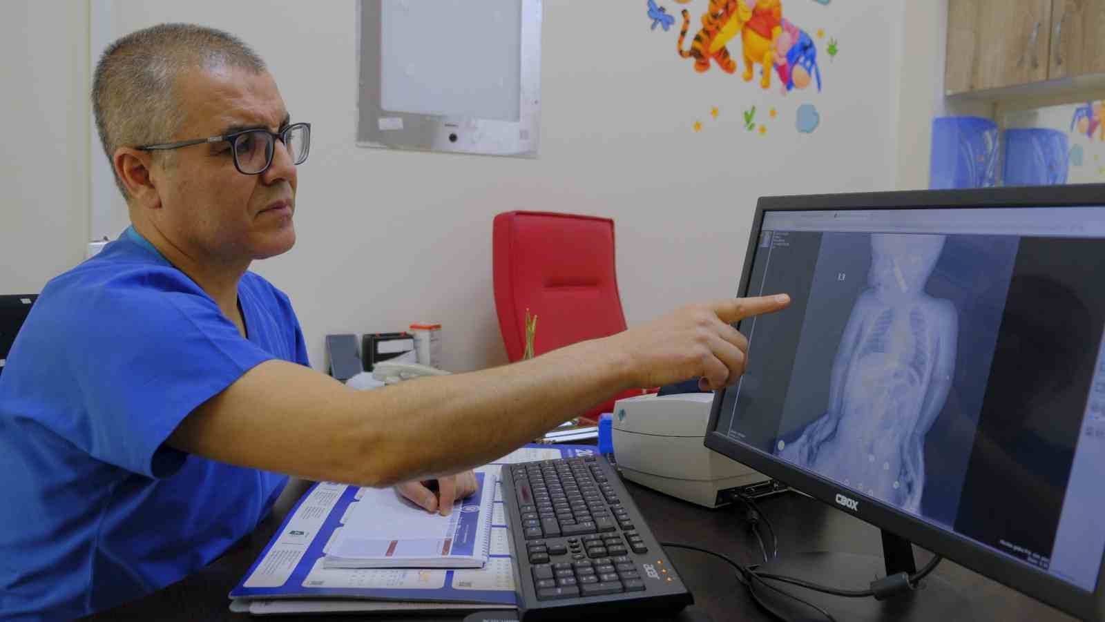 Karaman’da boğazına kumanda pili kalan kaçan bebek ölümden döndü