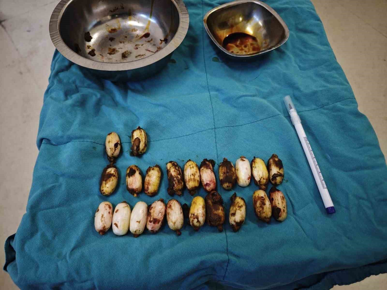 Midesinde taşıdığı uyuşturucu maddeler polisin dikkatinden sayesinde ele geçirildi