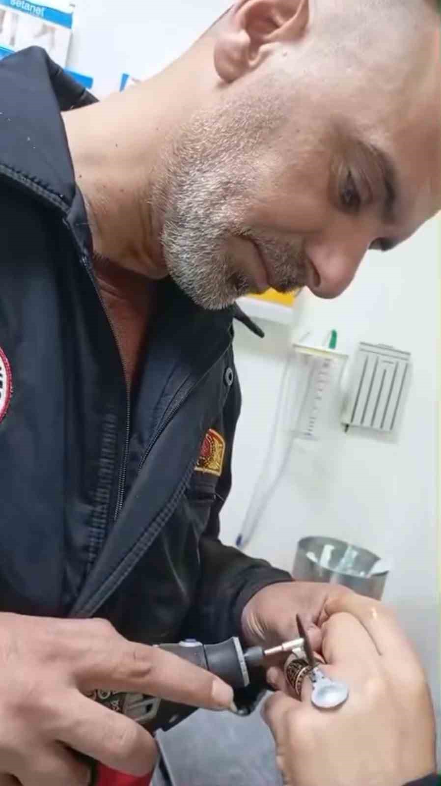 Sıkışan yüzük itfaiye ekiplerince çıkarıldı