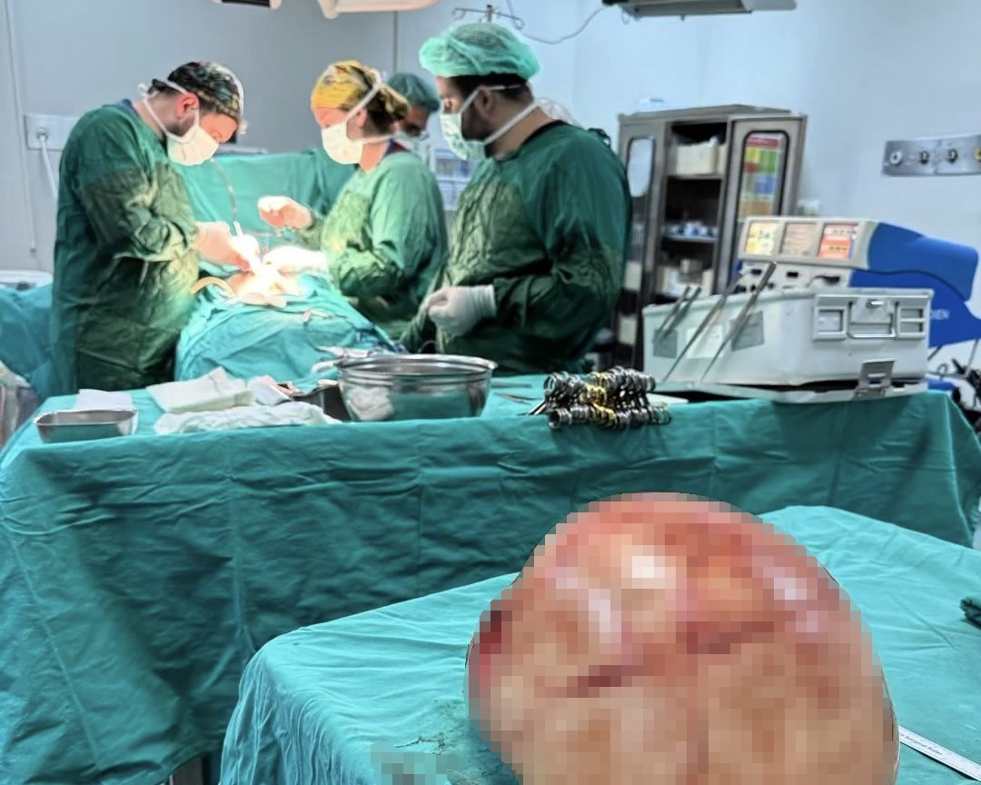 Van’da bir kadının karnından 35 santimetrelik dev kitle çıkarıldı