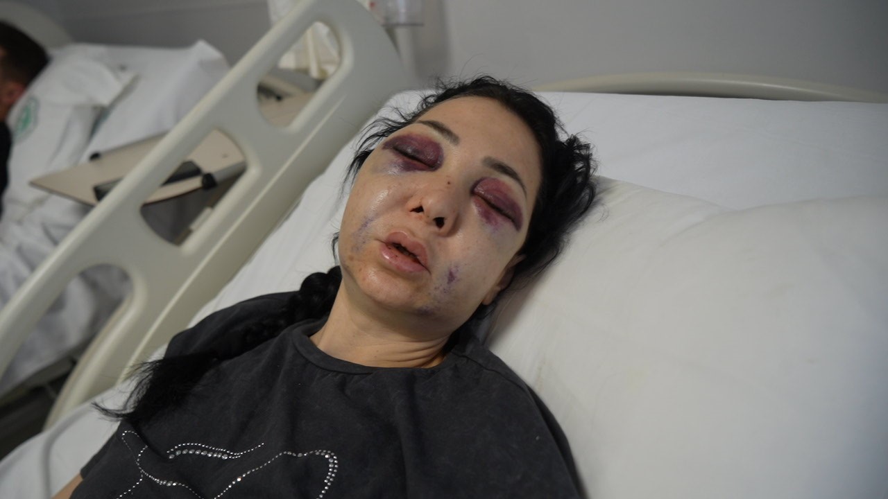 Anne ve oğlunun darp edilmesine ilişkin gözaltına alınan 3 şüpheliden 1’i tutuklandı