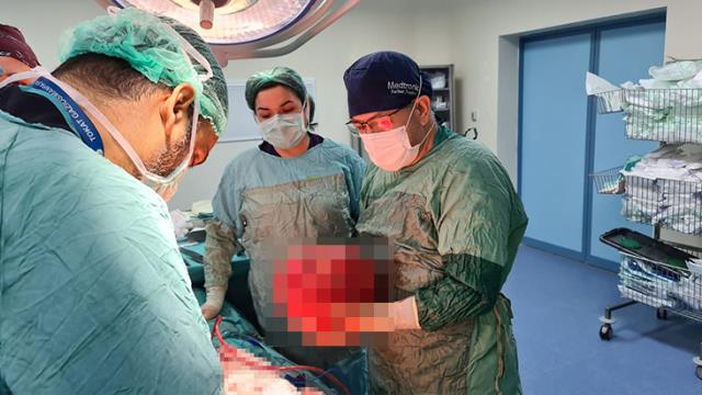 Kilo aldığını sanan adamın karnından çıkanlara doktorlar bile inanamadı