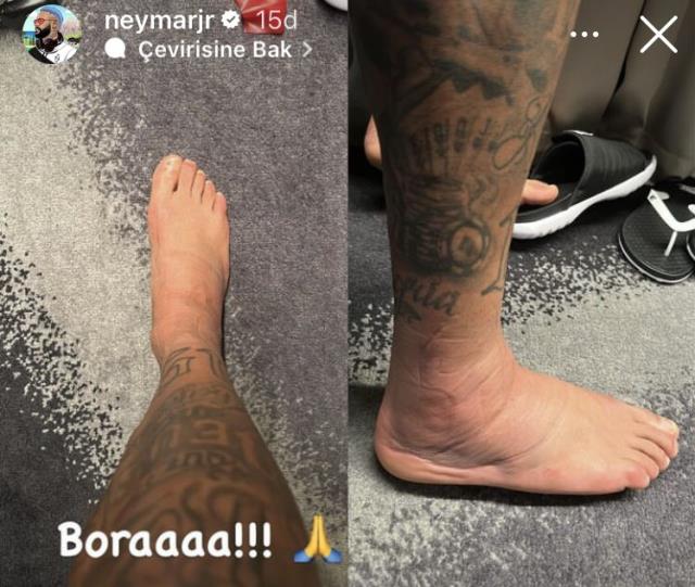 Görenler inanmakta güçlük çekiyor! Neymar ayağının içler acısı son halini paylaştı