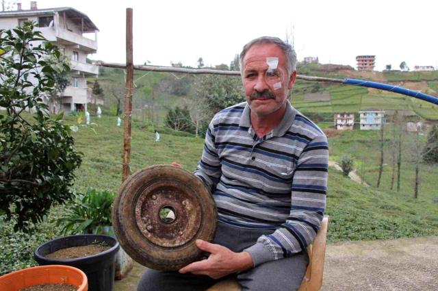 Hava bastığı lastik bomba gibi patladı, bir gözünü kaybetti