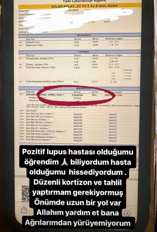 Dilan Polat hastalığı ne, sağlık durumu ne? Dilan Polat hasta mı?