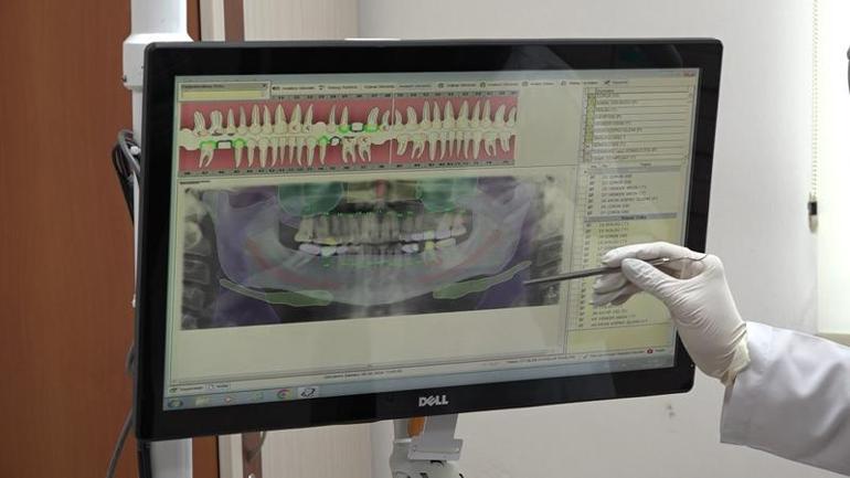 Türkiye’nin ilk 'yapay zeka’ destekli diş muayenesi Eskişehir’de yapıldı