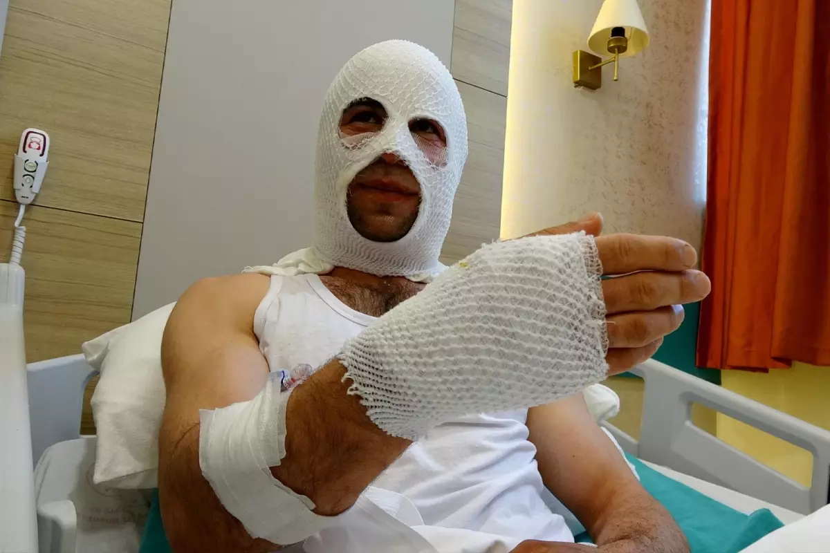 Nişanlısına hediye hazırlarken sprey boya kutusu bomba gibi patladı