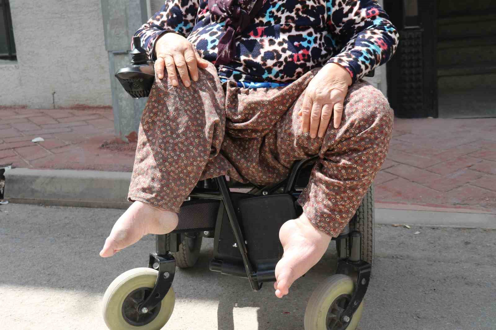 63 yıldır sürünen Hatice teyzenin yürek yakan dramı