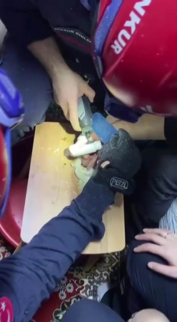 Parmağını kombi borusuna sıkıştırdı