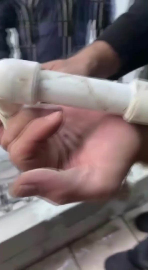 Parmağını kombi borusuna sıkıştırdı