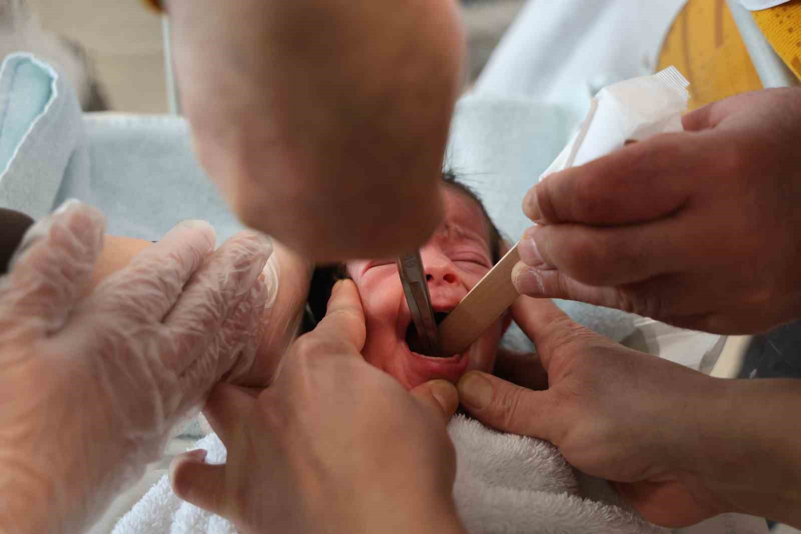 Doğuştan yemek borusu olmayan 4 günlük bebek, Elazığ’da hayata tutundu