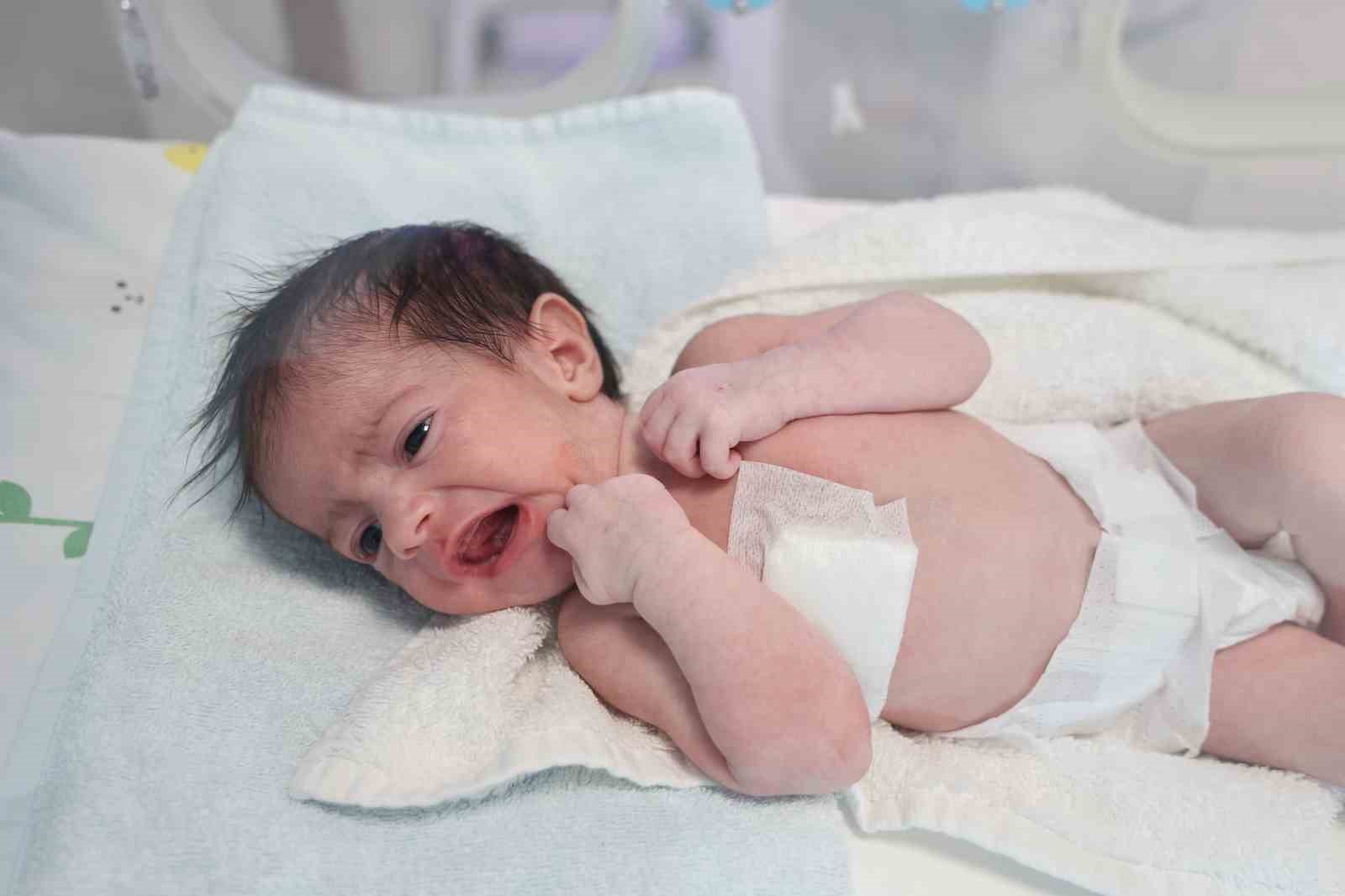 Doğuştan yemek borusu olmayan 4 günlük bebek, Elazığ’da hayata tutundu