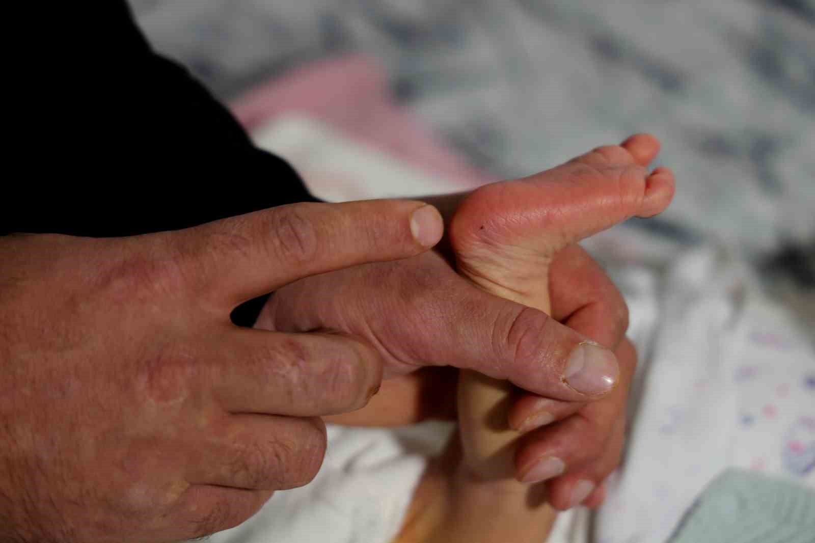 Topuk kanı çıkmazı: Bebeklerine kayyum atanması endişesiyle yaşıyorlar